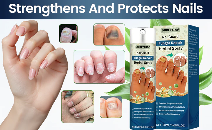 NailGuard Fungal Repair Herbal Spray - Image 4