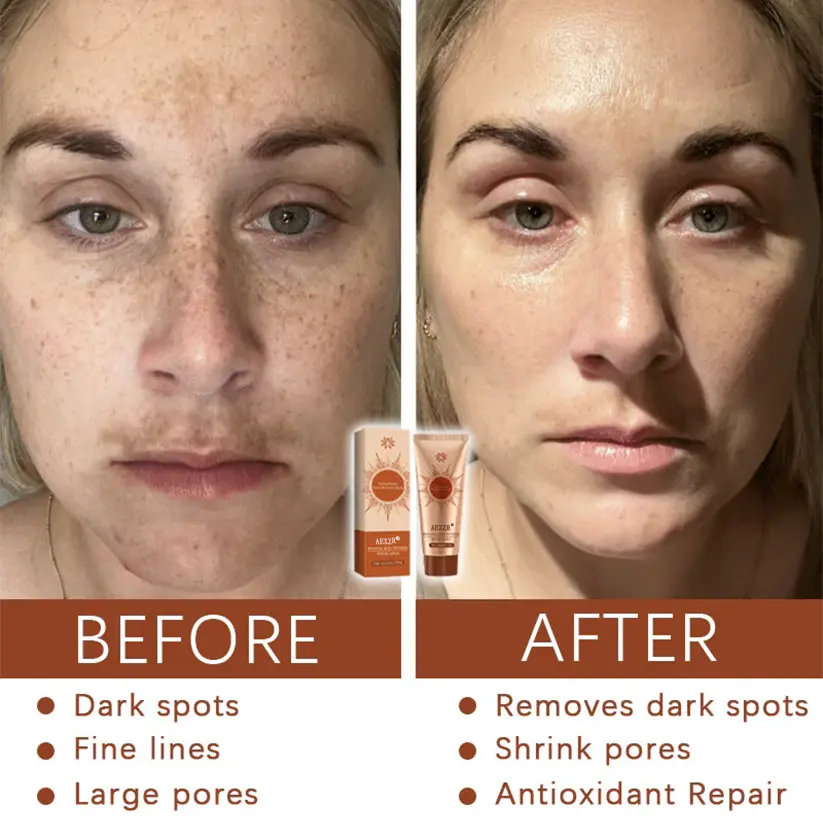 Herbal Flecken Peel-Off Gesichtsmaske | BEGRENZTES RABATTANGEBOT✨ - Image 4