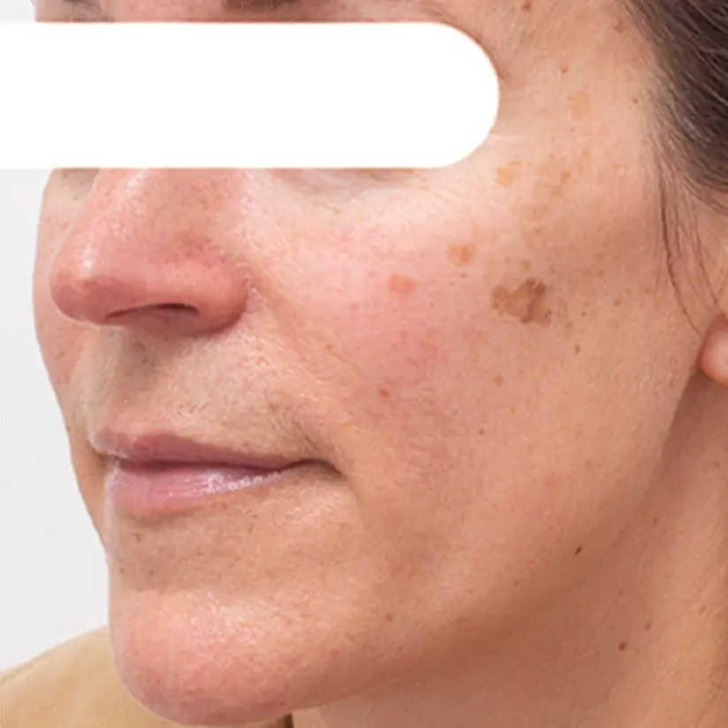 Herbal Flecken Peel-Off Gesichtsmaske | BEGRENZTES RABATTANGEBOT✨ - Image 5