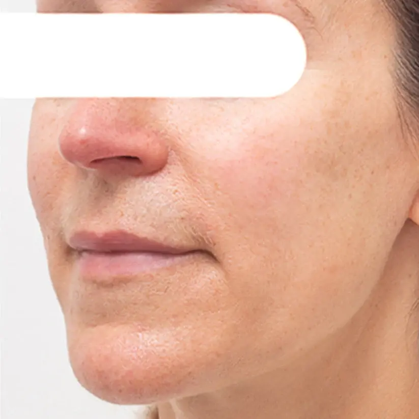 Herbal Flecken Peel-Off Gesichtsmaske | BEGRENZTES RABATTANGEBOT✨ - Image 6