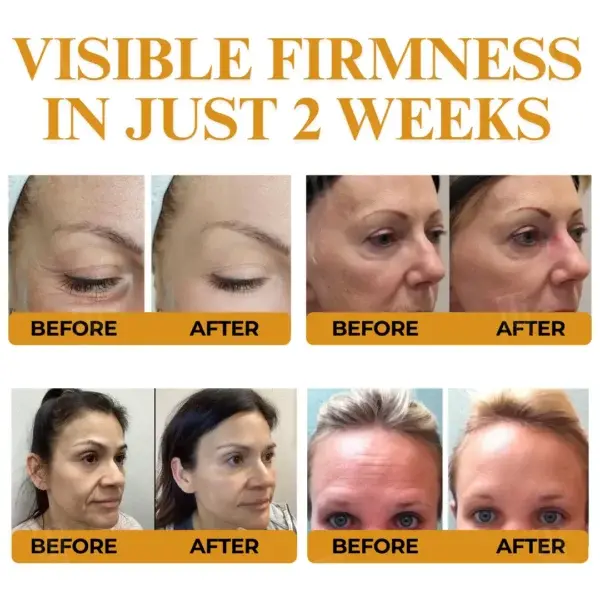 Letybo Bee Venom Wrinkle Removal Cream - Image 3