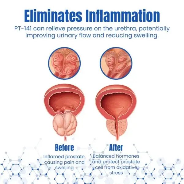 ProstaAce PT-141 Nasal Spray - Image 2