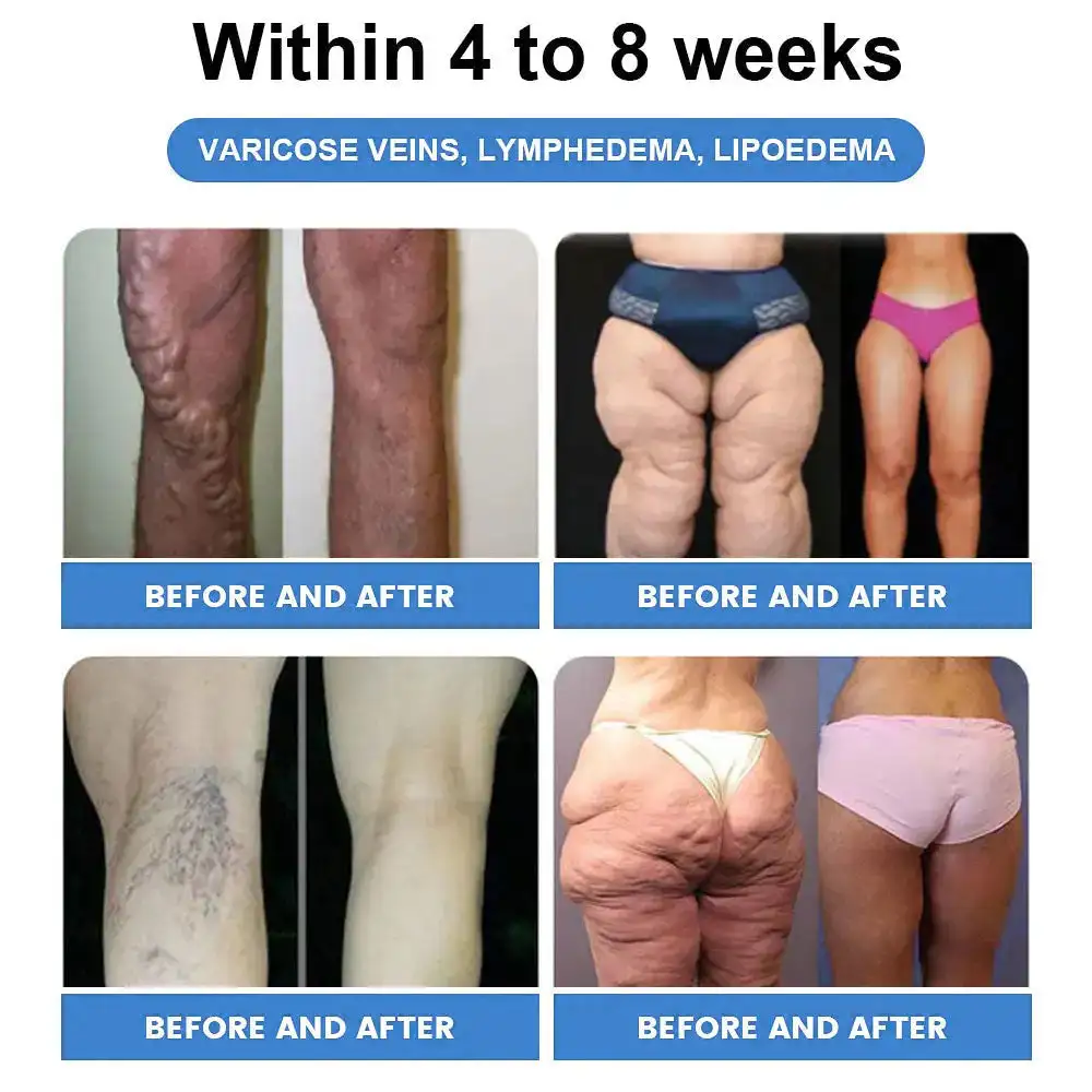 ðððŠð ð¶ððððð ð
ðððððððððð | ðððððððð ðð¡ððð | SLIMMING & HEALTHCARE DROPS - ðšââïžðððð ðð¡ðŠ,ð¶ðððððð£ðð ðð¢ððð ð·ðð ððð , ð·ððððð¡ðð , ððððð ðŽðððð, ðœðððð¡ ðððððððð ððð ðððð - Image 10