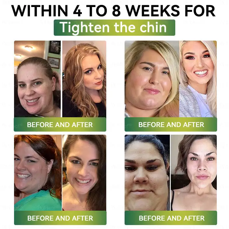 Nano Patch | Needle-Free Support for Weight, Glucose, Sleep & Joint Wellness 💪 - Image 6