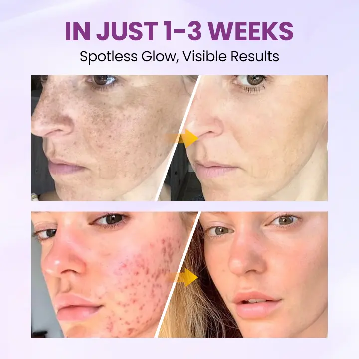 Radiant Clear Blemish & Brightening Serum - Image 6