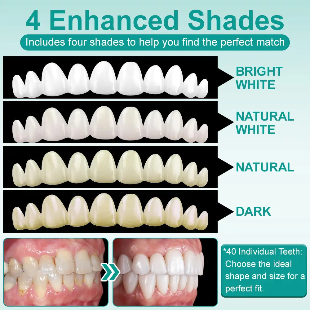 ๐๐ป๐๐๐ฎ๐ป๐ ๐ฆ๐๐ถ๐ฐ๐ธ-๐ผ๐ป ๐๐ฒ๐ป๐๐ฎ๐น ๐ฉ๐ฒ๐ป๐ฒ๐ฒ๐ฟ๐ (โ
Clinically proven, easy-to-use dental veneers trusted by over 8,000 US users for a comfortable, natural smile.) - Image 5