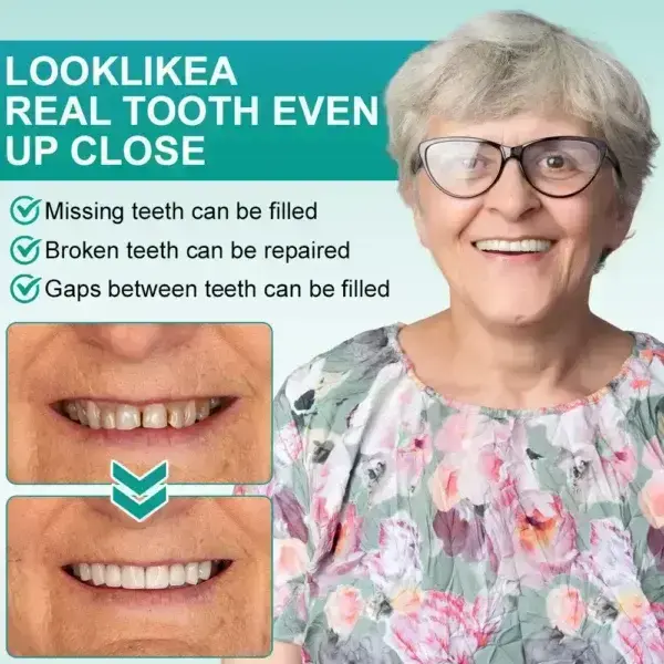 ๐๐ป๐๐๐ฎ๐ป๐ ๐ฆ๐๐ถ๐ฐ๐ธ-๐ผ๐ป ๐๐ฒ๐ป๐๐ฎ๐น ๐ฉ๐ฒ๐ป๐ฒ๐ฒ๐ฟ๐ (โ
Clinically proven, easy-to-use dental veneers trusted by over 8,000 US users for a comfortable, natural smile.) - Image 3