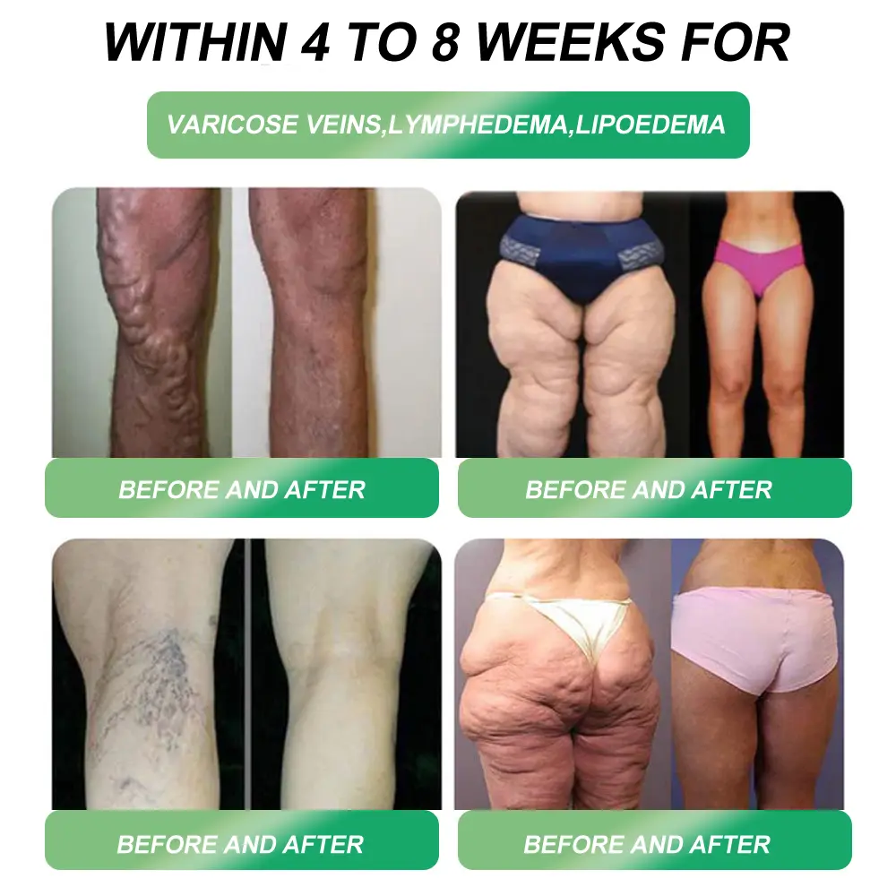 Weight Loss Drops - Image 13