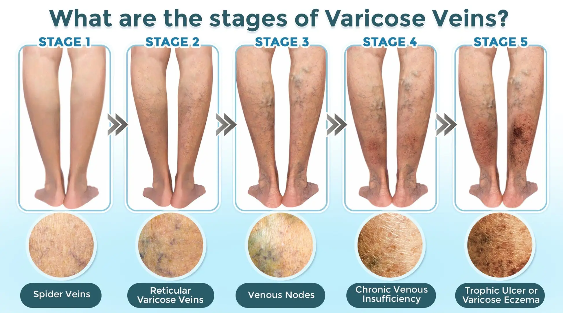 VenaRestore MicroNeedle Vein Repair Patch - Image 7