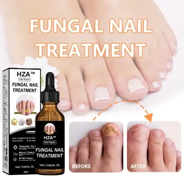 Fungal Nail Treatment - Image 3