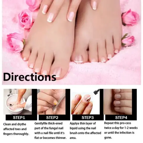 Fungal Nail Treatment - Image 4