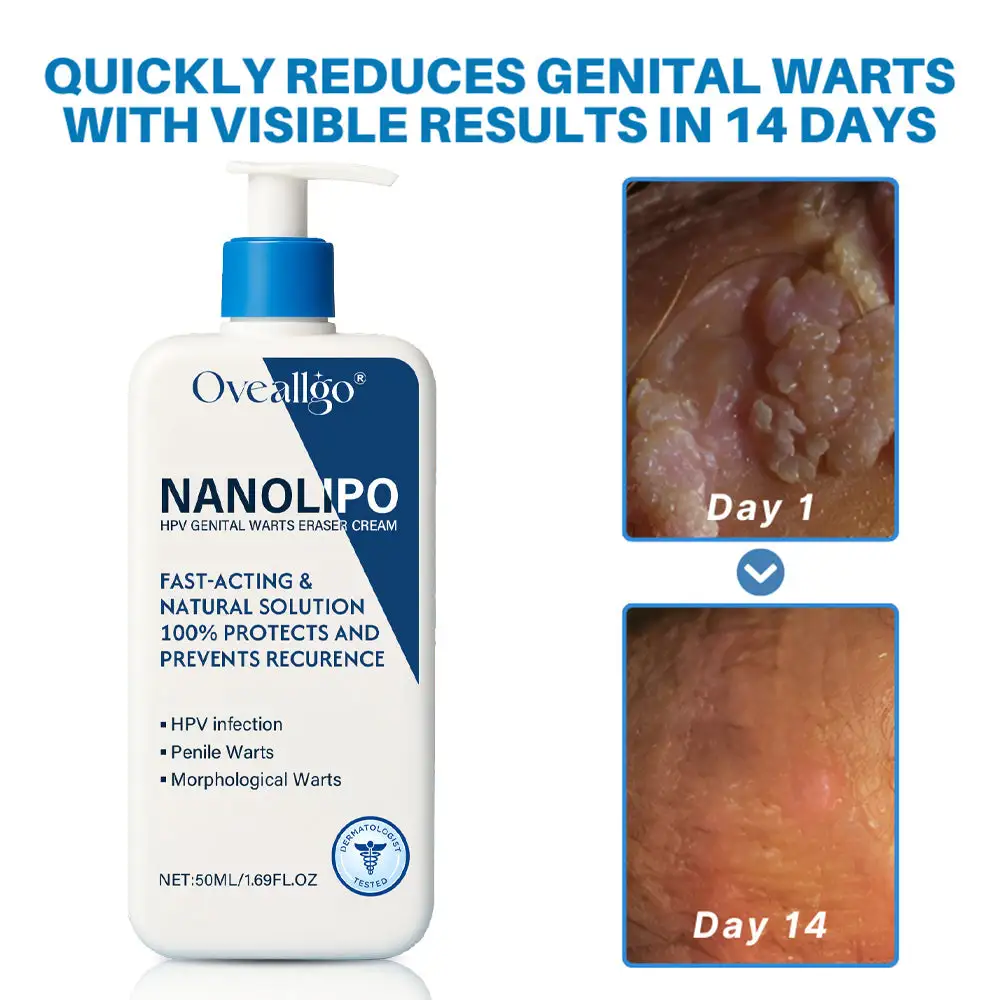 NanoLipo HPV Genital Warts Eraser Cream - Image 2
