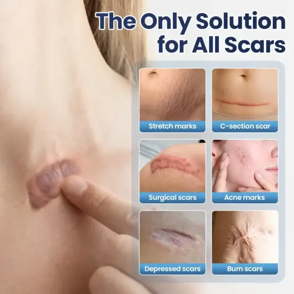 DERMALUX Texture Repair Gel - Image 5