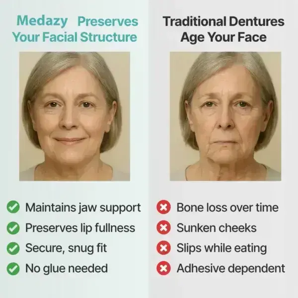 【OFFICIAL Custom-Fit Full Functional Dentures - Image 7