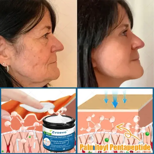 ✅Official Store: Magnesium Skin Repair Cream (Smooths Wrinkles, Firms Skin and Fades Stretch Marks) - Image 4