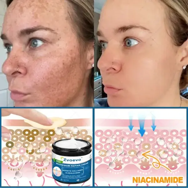 ✅Official Store: Magnesium Skin Repair Cream (Smooths Wrinkles, Firms Skin and Fades Stretch Marks) - Image 6