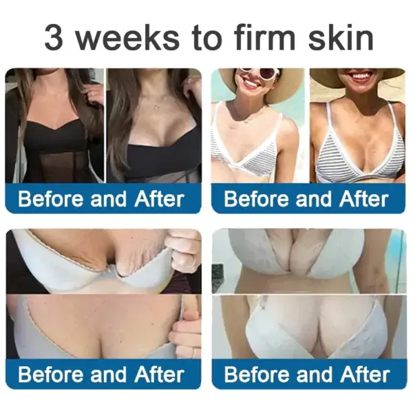 ✅Official Store: Magnesium Skin Repair Cream (Smooths Wrinkles, Firms Skin and Fades Stretch Marks) - Image 7