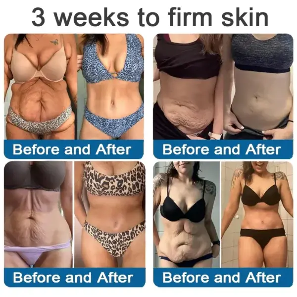 ✅Official Store: Magnesium Skin Repair Cream (Smooths Wrinkles, Firms Skin and Fades Stretch Marks) - Image 8