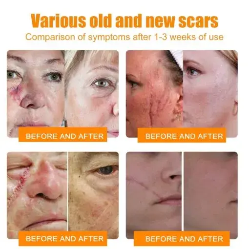 Bee Venom Wart & Tag Removal Cream - Image 10