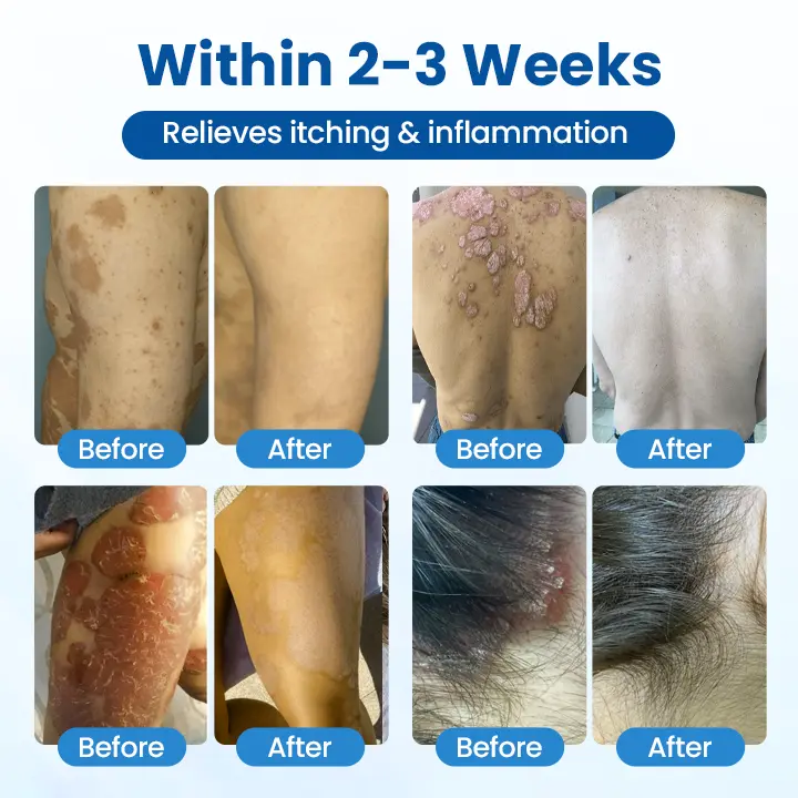 PCA Magnesium Deep Repair Spray - Image 8