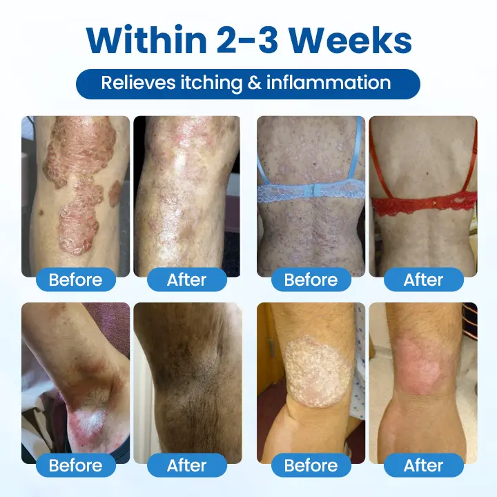 PCA Magnesium Deep Repair Spray - Image 9