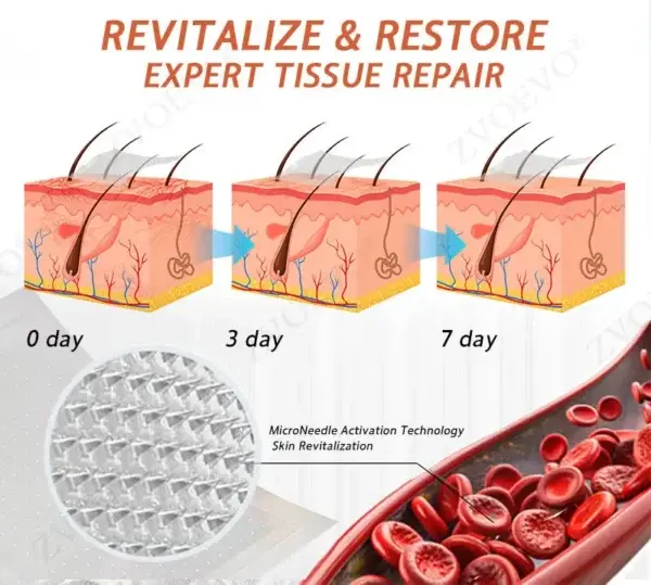 Vein Ease Microneedle Care Patch(For Spider Veins, Varicose Veins, Swelling & Leg Fatigue) - Image 11