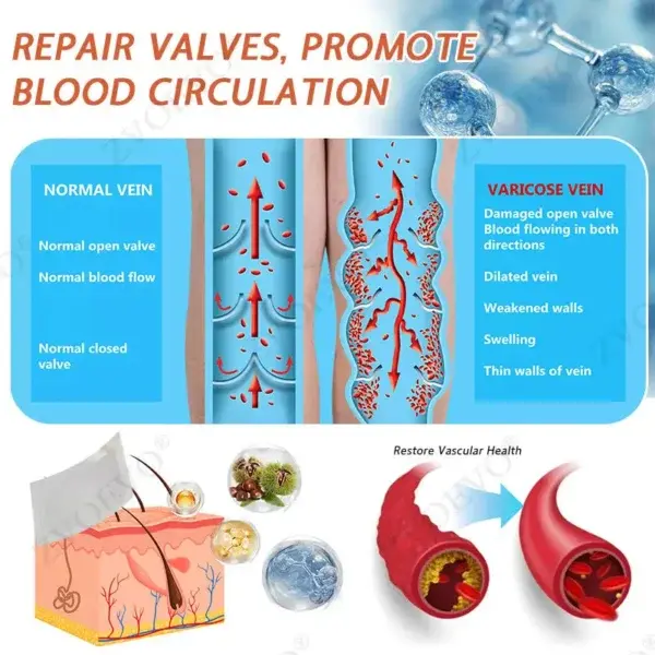 Vein Ease Microneedle Care Patch(For Spider Veins, Varicose Veins, Swelling & Leg Fatigue) - Image 3
