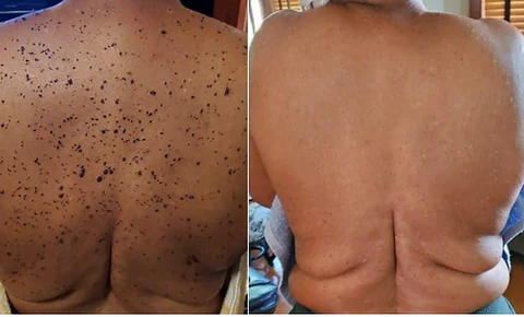 DR. JOYIAU BEE VENOM Warts & Spots Removal Cream - Image 4