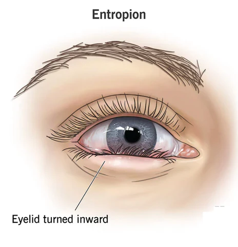 OPENEYES Awaken Peptide Lifting Eye Gel - Image 7