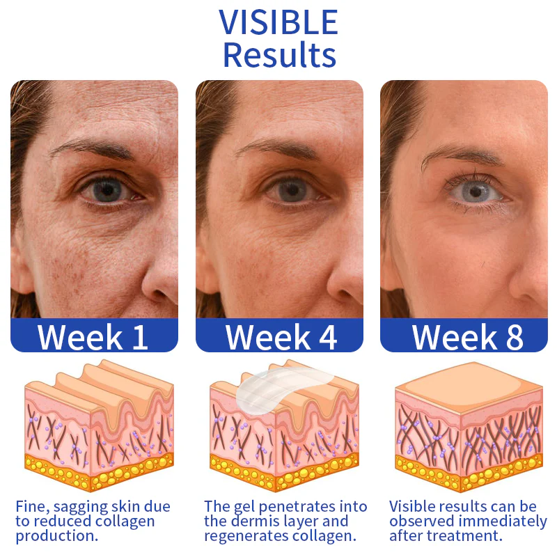 OPENEYES Awaken Peptide Lifting Eye Gel - Image 5