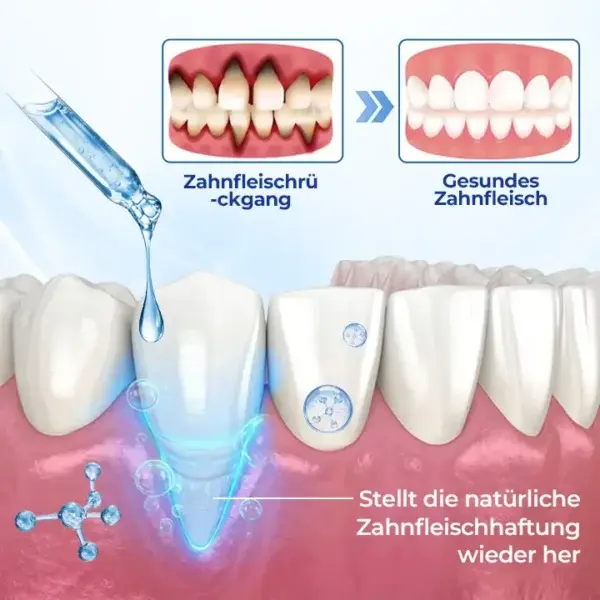 BeeTakt Zahnfleisch-Repair Lösung - Image 11
