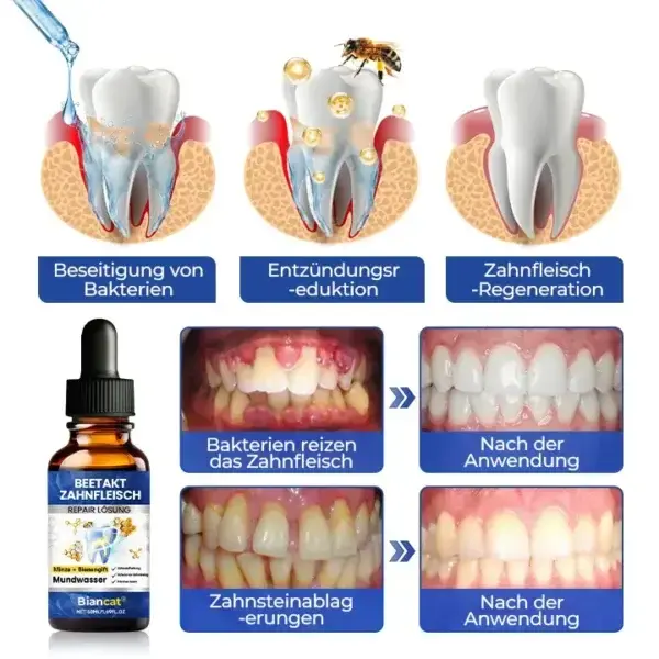 BeeTakt Zahnfleisch-Repair Lösung - Image 6