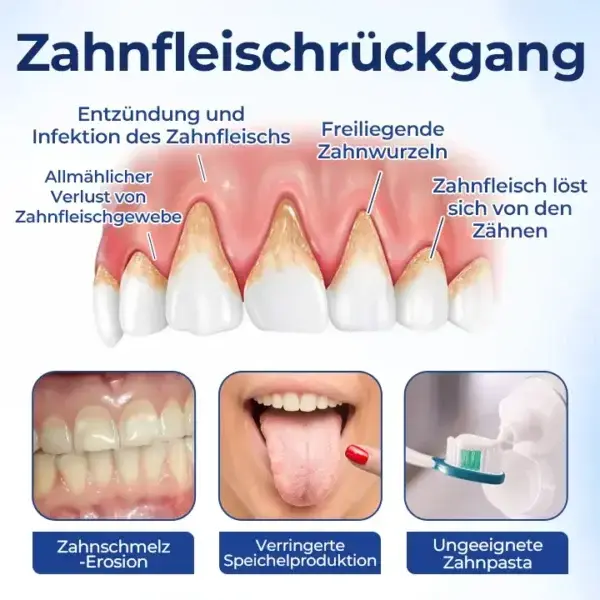BeeTakt Zahnfleisch-Repair Lösung - Image 7