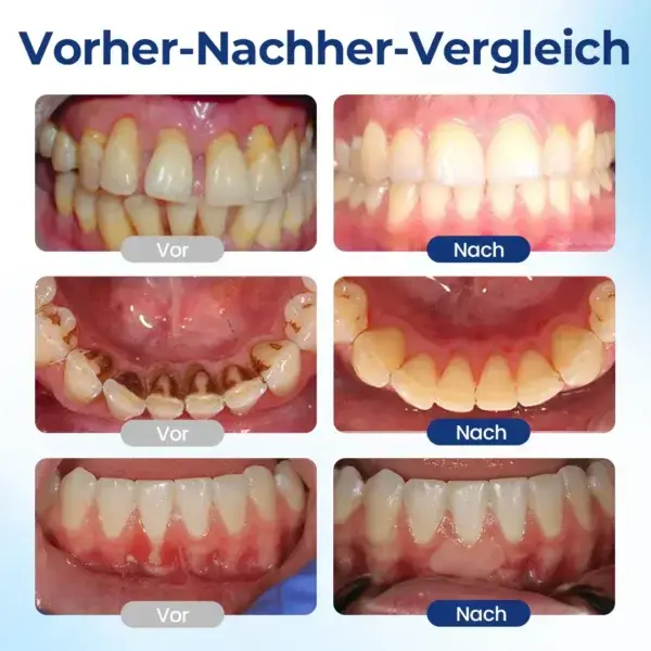 BeeTakt Zahnfleisch-Repair Lösung - Image 9