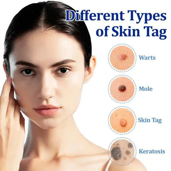 BeeDerm RX Cream - Image 7