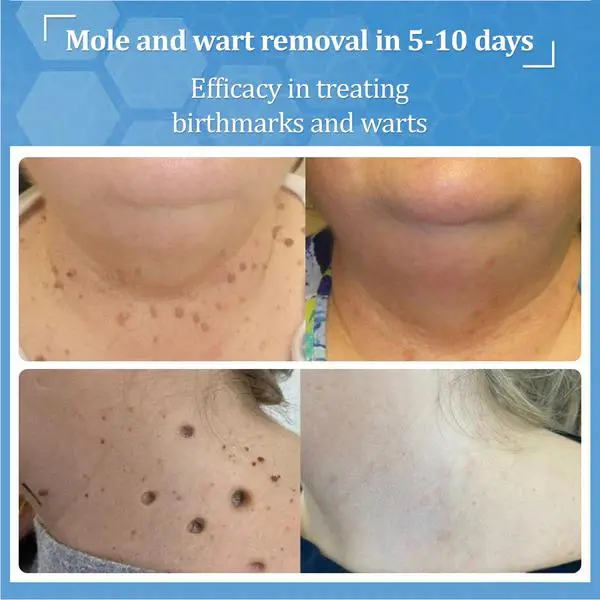 BeeDerm RX Cream - Image 10