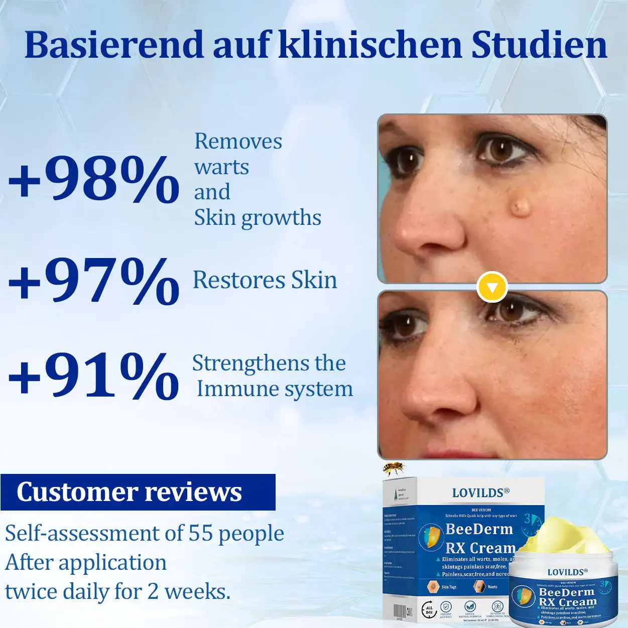 BeeDerm RX Cream - Image 5