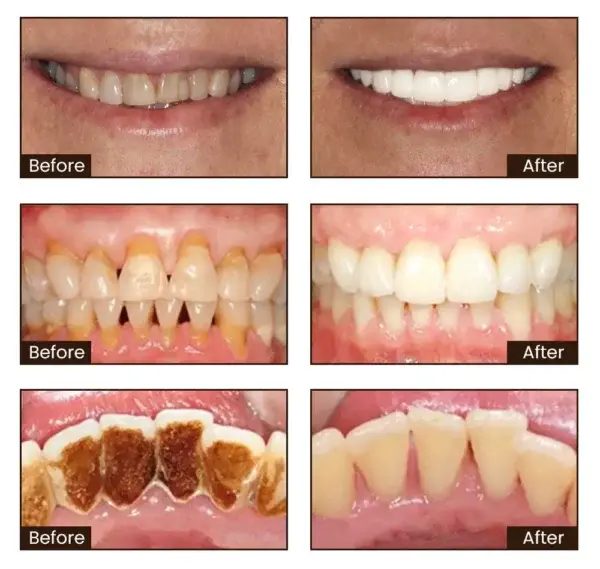 Niacinamide Whitening Toothpaste - Image 14