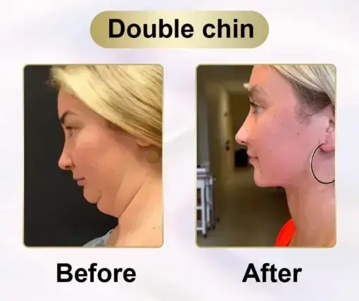 Metatrolide & Moringa activation, Apple cider vinegar, Turmeric Herbal Oral Liquid: Obesity,Cardiovascular Diseas, Diabetes, Sleep Apnea, Joint Problems, and More - Image 3