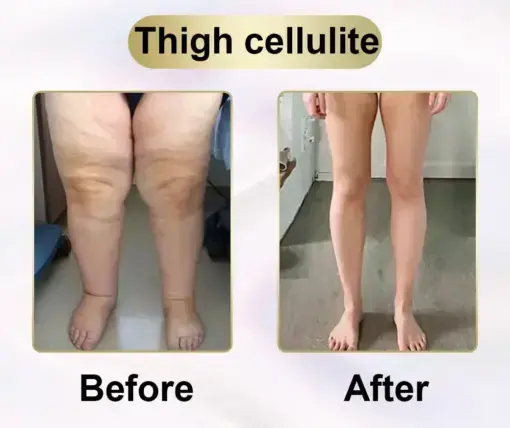 Metatrolide & Moringa activation, Apple cider vinegar, Turmeric Herbal Oral Liquid: Obesity,Cardiovascular Diseas, Diabetes, Sleep Apnea, Joint Problems, and More - Image 6